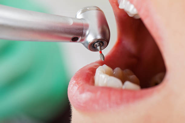 Best Emergency Treatment for Toothache in Burns Flat, OK